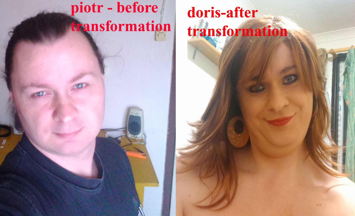 doris before and after